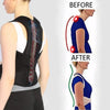 Image of AlignBack Posture Corrector for hunchback: Effective Brace for Correcting Poor Posture & Relieving Hunchback Transform Your Posture