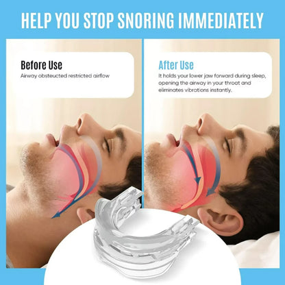 Ultimate Snoring Mouth Guard: Stop Snoring Solution, Anti Snore Device for Peaceful Nights - Mouth Guards for Sleep Apnea Relief