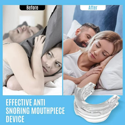 Ultimate Snoring Mouth Guard: Stop Snoring Solution, Anti Snore Device for Peaceful Nights - Mouth Guards for Sleep Apnea Relief