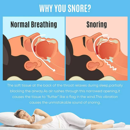 Ultimate Snoring Mouth Guard: Stop Snoring Solution, Anti Snore Device for Peaceful Nights - Mouth Guards for Sleep Apnea Relief