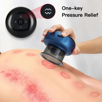 Cupping Massager with Heating Function | Electric Vacuum Device for Targeted Muscle Therapy