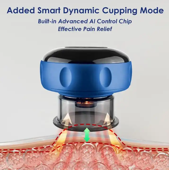 Cupping Massager with Heating Function | Electric Vacuum Device for Targeted Muscle Therapy