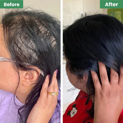 Organic Batana Oil for Hair Growth - Prevent Hair Loss & Promote Healthy Hair | Raw Batana Oil