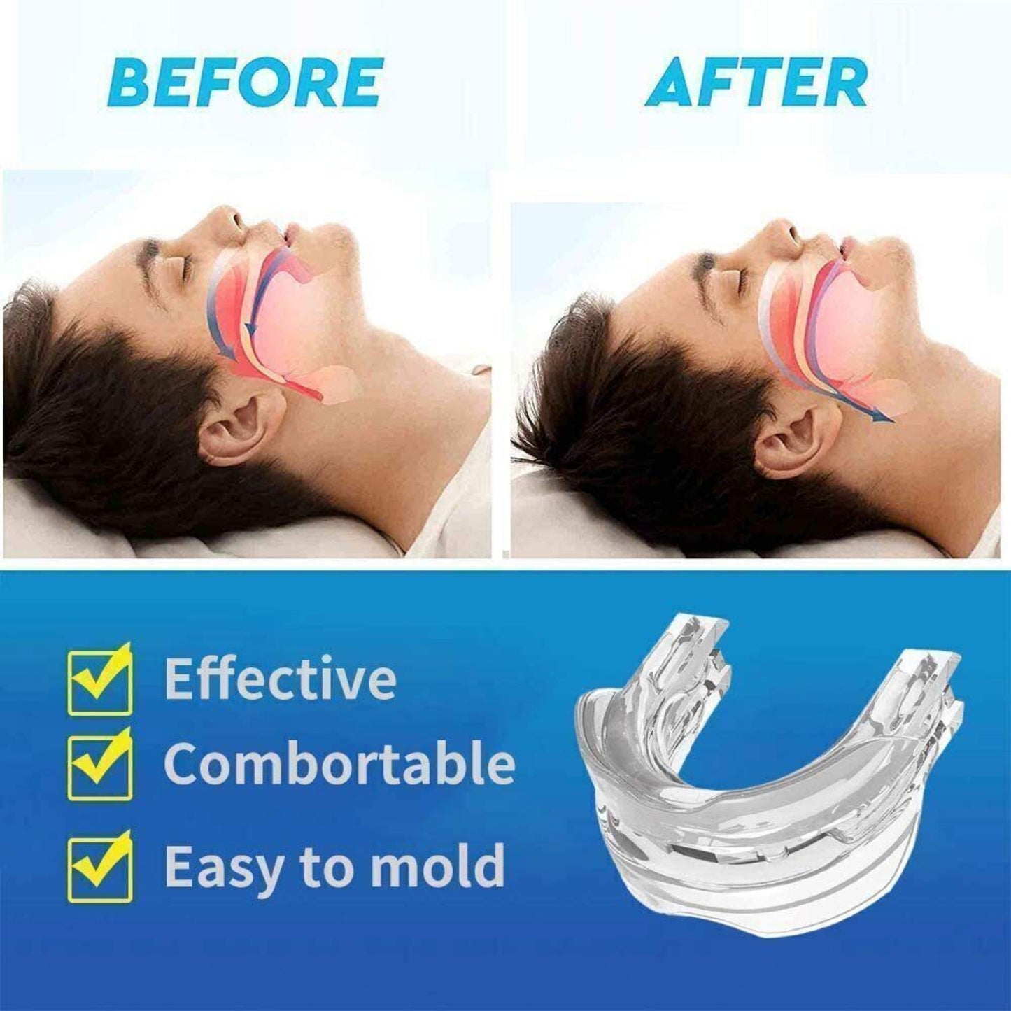 Ultimate Snoring Mouth Guard: Stop Snoring Solution, Anti Snore Device for Peaceful Nights - Mouth Guards for Sleep Apnea Relief