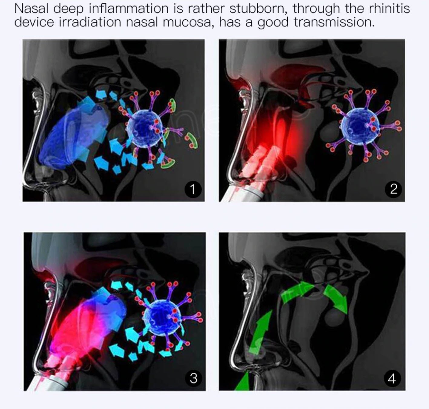 Infrared Rhinitis Therapy Device - Balma Home