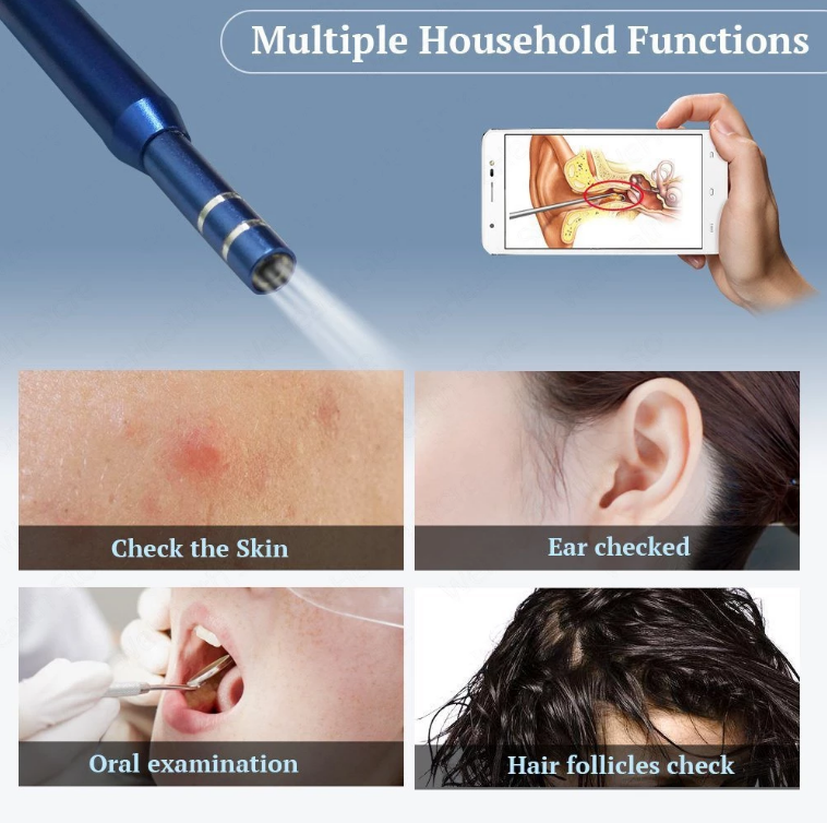 ear-cleaning-kit