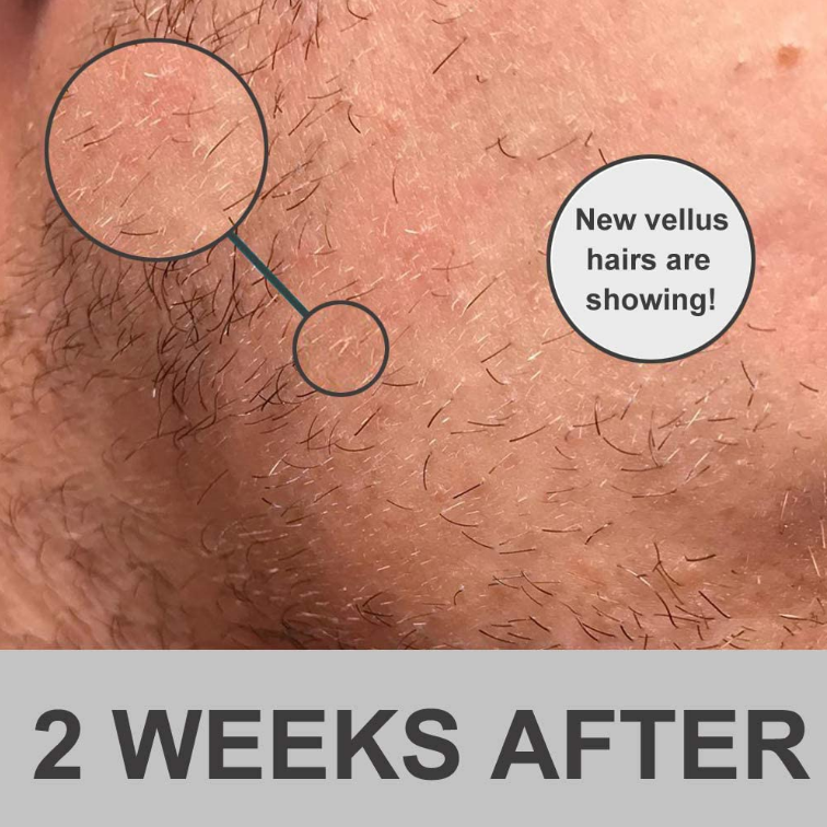 beard-growth-supplement