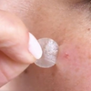 Image of pimple-patches