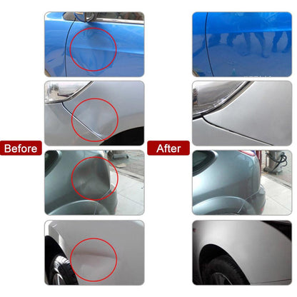 dent-removal-kit