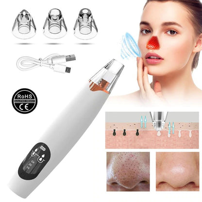 Original Blackhead Remover Pore Vacuum - Best Blackhead Remover Pearl White