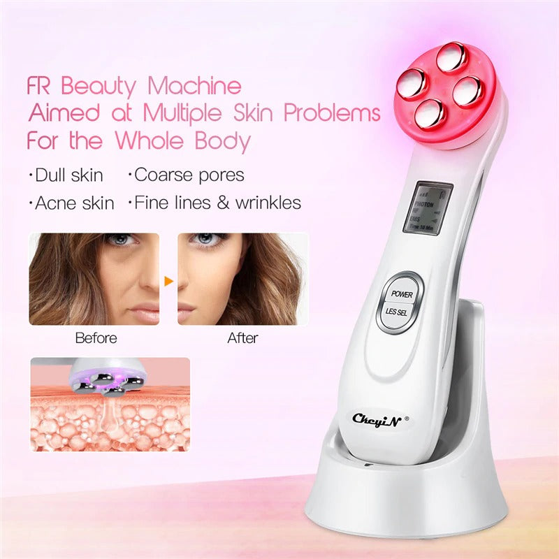 MLAY RF Radio Frequency Face Lifting Device & Wrinkle Remove, Skin Lifting