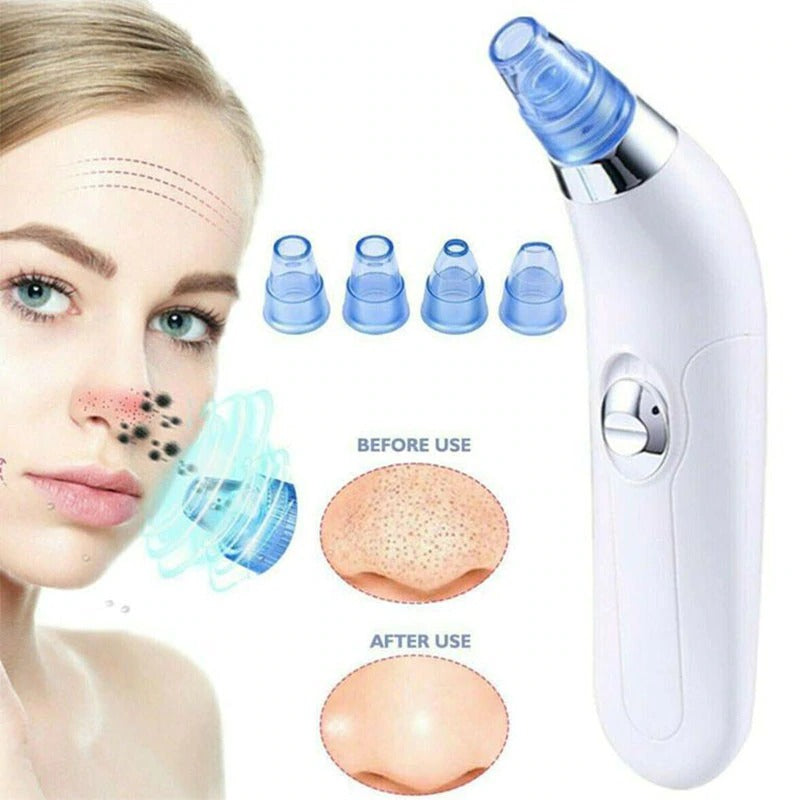 4 Heads T-zone Electric Acne Remover Pore Suction