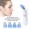 Image of 4 Heads T-zone Electric Acne Remover Pore Suction