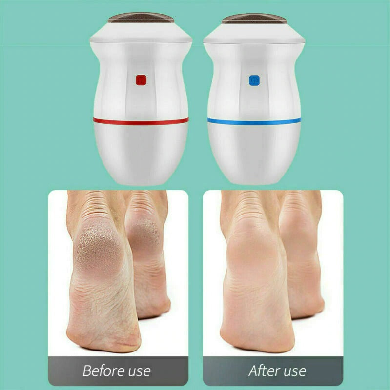 Callus Remover with Built-In Vacuum Rechargeable Motorized Electric Feet Foot File Pedicure Tool Exfoliation Dead Skin | Fitolix