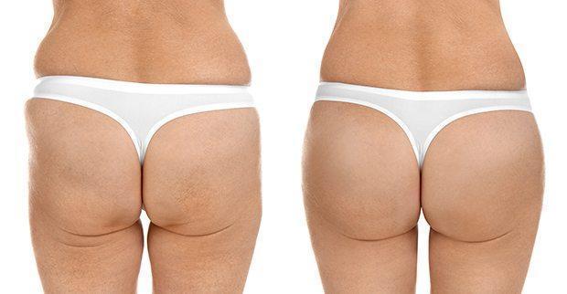 Advanced Hip Lift-up Cream - Balma Home